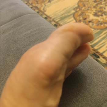 Ayak Sağlığını Zedeleyen Ayakkabının Değişim Talebi Reddedildi