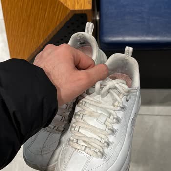 Ayakkabının Arka Bileğinde Erken Parçalanma Ve Mağaza Reddine Karşı İade Talebi