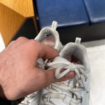 Ayakkabının Arka Bileğinde Erken Parçalanma Ve Mağaza Reddine Karşı İade Talebi