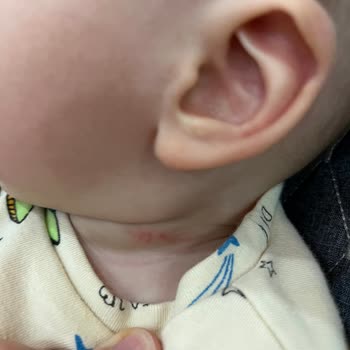 Ebebek'ten Aldığım Yemek Önlüğü Bebeğimin Boynunu Tahriş Etti