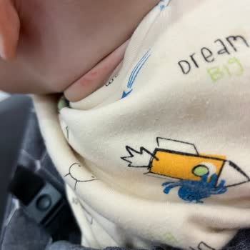 Ebebek'ten Aldığım Yemek Önlüğü Bebeğimin Boynunu Tahriş Etti