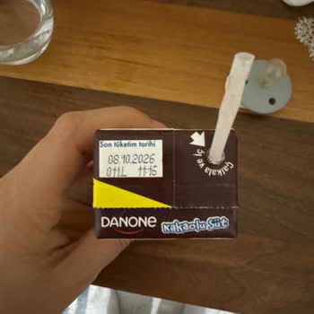 Kızımın Süt Ürününde Kıl Bulunması Hijyen Ve Güven Sorunu