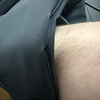 Mavi Black Parka Montunda Erken Renk Atması Ve Doku Bozulması İade Talebi