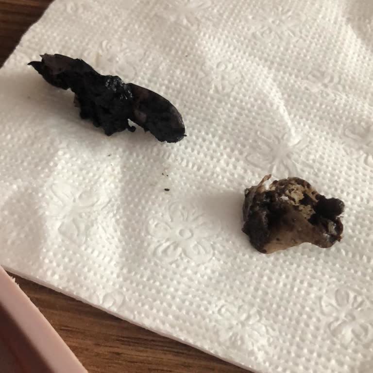 Kalitesiz Zeytin Ve İade Sürecindeki İhmal