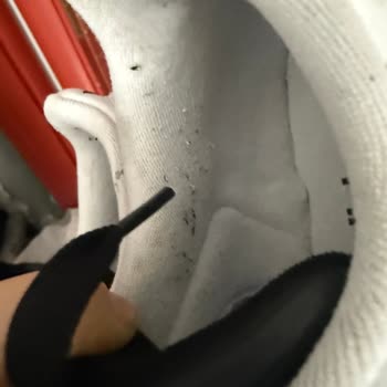9 Ay Sonra Ayıplı Adidas Superstar Ayakkabı İncelemesi Reddedildi