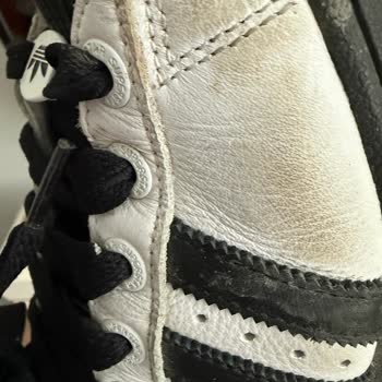 9 Ay Sonra Ayıplı Adidas Superstar Ayakkabı İncelemesi Reddedildi