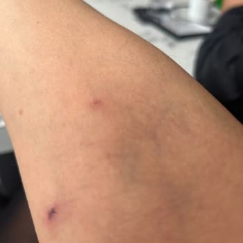 İstinye Üniversitesi Hastanesi Hem Maddi Hem Manevi Zarara Uğradım