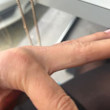 İstinye Üniversitesi Hastanesi Hem Maddi Hem Manevi Zarara Uğradım