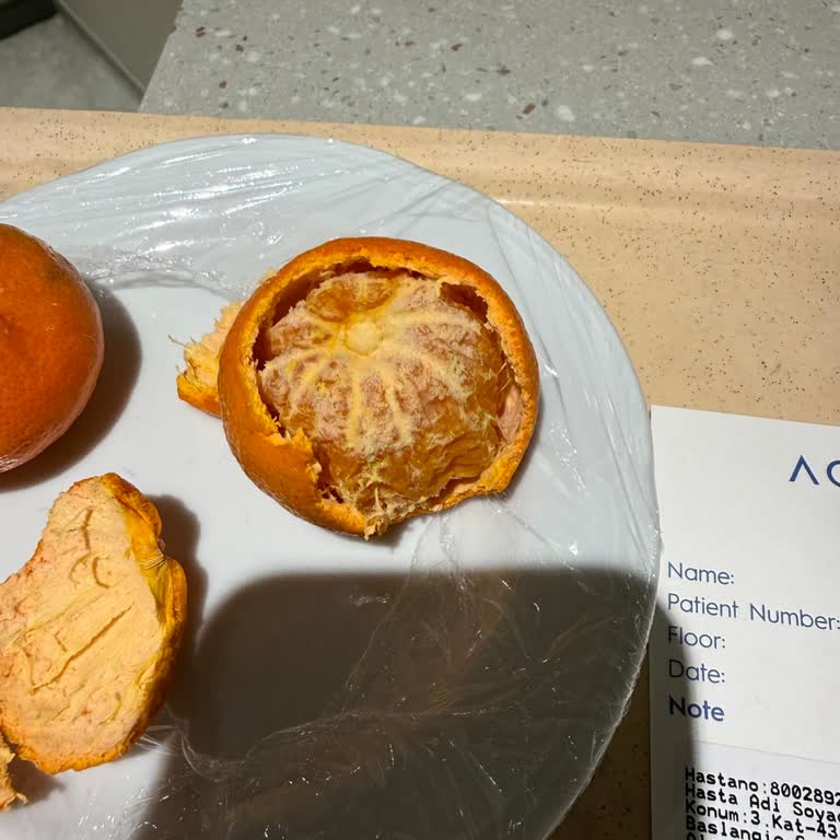 Acıbadem Hastanesinde Kalitesiz Mandalina Servisi Hastaların Sağlığını Tehdit Ediyor