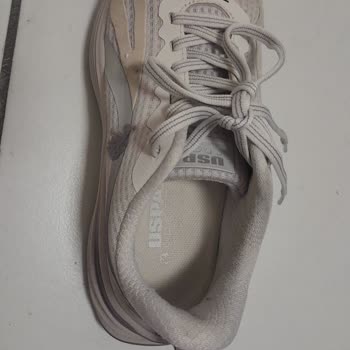 Ayakkabım İki Ayda Yırtıldı, Kullanıcı Hatası İddiası Ve İade Talebi