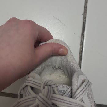 Ayakkabım İki Ayda Yırtıldı, Kullanıcı Hatası İddiası Ve İade Talebi