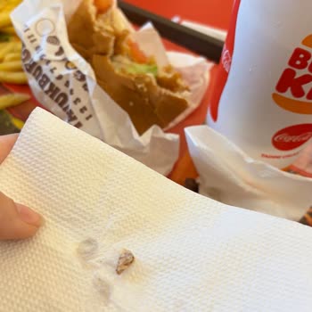 Burger King Hamburgerinde Sert Cisim Bulundu, Dişim Kırıldı Ve Çözüm Sunulmadı