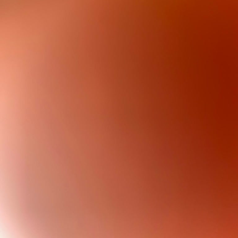 Kocaeli Belediyesi 41 Kart Burs Ödemesinin Gecikmesi Ve Bilgilendirme Eksikliği