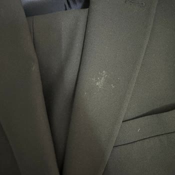 Üründe Leke, Gevşek Düğmeler Ve Eksik Martı Amblemi: Müşteri Hizmetlerinin İlgisizliği