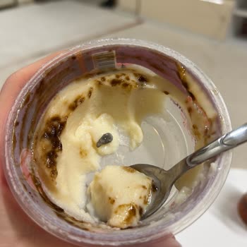 Eker Kazandibi Tatlısında Taş Bulunması Ortodonti Telimin Kırılmasına Yol Açtı