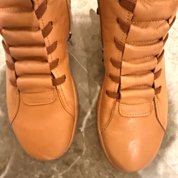 Tergan Botunun Dikiş Asimetrisi Ve Değişim Talebi