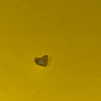 Forlife Fındıklı Çikolatasında Taş Benzeri Parçalar Ve Diş Sorunu