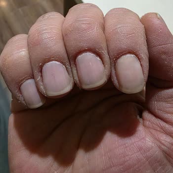 Renk Uyuşmazlığı Ve Yüksek Ücret Nedeniyle 22.250 TL İade Talebi