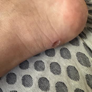 Kusursuz Çizme Ayak Sağlığına Zarar Verdi, İade Reddedildi