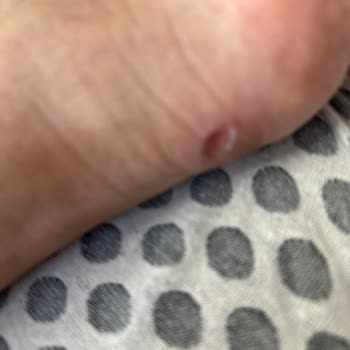 Kusursuz Çizme Ayak Sağlığına Zarar Verdi, İade Reddedildi