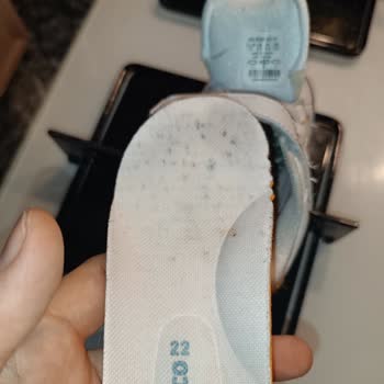 Vicco Bebek Ayakkabısında Küflü İç Kısım Ve Yapısal Sorunlar İade Talebi