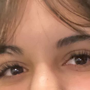 İpek Kirpik İşlemi Sonrası Hızlı Dökülme Ve Cevapsız Müşteri Hizmeti