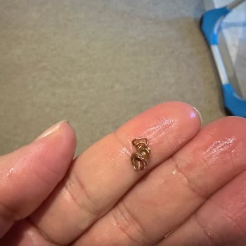 Ülker Metro Çikolatasında Tel Parçası Bulunması Ve Boğaz Tehlikesi