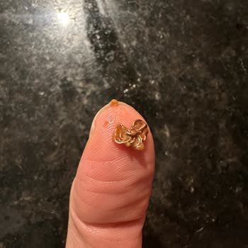 Ülker Metro Çikolatasında Tel Parçası Bulunması Ve Boğaz Tehlikesi