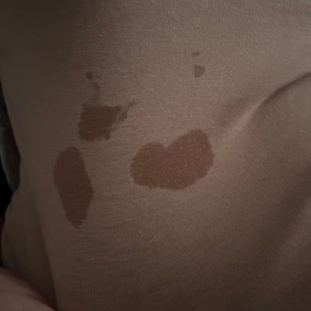 Lansinoh Tekli Süt Akıtma Sorunu Ve Hızlı Değişim Talebi