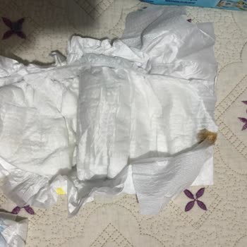 Molfix Ultra Bebek Bezlerinde Hasarlı Ürün Ve Güvenlik Endişesi