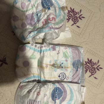 Molfix Ultra Bebek Bezlerinde Hasarlı Ürün Ve Güvenlik Endişesi