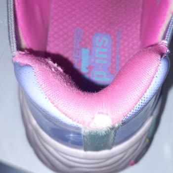 Kısa Sürede Deforme Olan Skechers Ayakkabıda Para İadesi Talebi