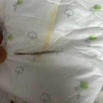 Yenidoğan Bezinde Odun Parçası Bulunması Güven Kaybına Neden Oldu