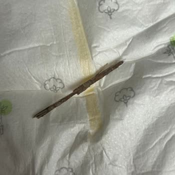 Yenidoğan Bezinde Odun Parçası Bulunması Güven Kaybına Neden Oldu