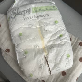 Yenidoğan Bezinde Odun Parçası Bulunması Güven Kaybına Neden Oldu