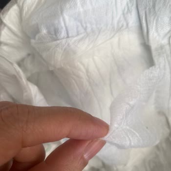Molfix'in Bezlerinde İç Pamuk Topaklanması Çocuğumun Cildini Tahriş Ediyor