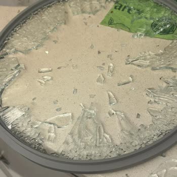 Patlayan Tencere Kapağı Nedeniyle Ciddi El Kesikliği Ve Sağlık Riski