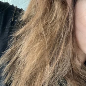 Saç Boyası Sonrası Ağır Yanma Ve Saç Dökülmesi İçin 7.000 TL İade Talebi