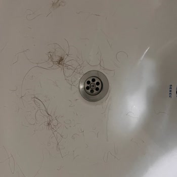 Saç Boyası Sonrası Ağır Yanma Ve Saç Dökülmesi İçin 7.000 TL İade Talebi