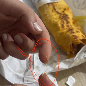 Tavuk Dürümde Tüy: Sağlık Riski Ve Yetersiz Telafi