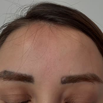 İşlemde Hatalı Renk Ve Aşırı Ücret İadesi Talebi