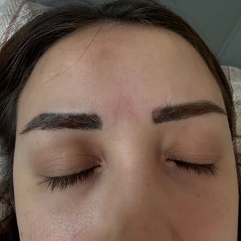 İşlemde Hatalı Renk Ve Aşırı Ücret İadesi Talebi