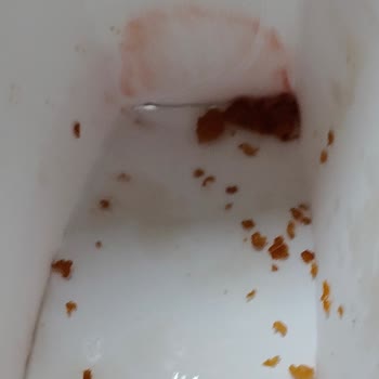 Burger King Hijyen Sorunu: Kirli Paket Ve Sandviçte Kemik