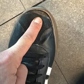 5500 TL'lik Adidas Ayakkabım 1 Yıl İçinde Ön Ve Yanlardan Açıldı