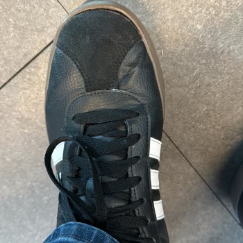 5500 TL'lik Adidas Ayakkabım 1 Yıl İçinde Ön Ve Yanlardan Açıldı