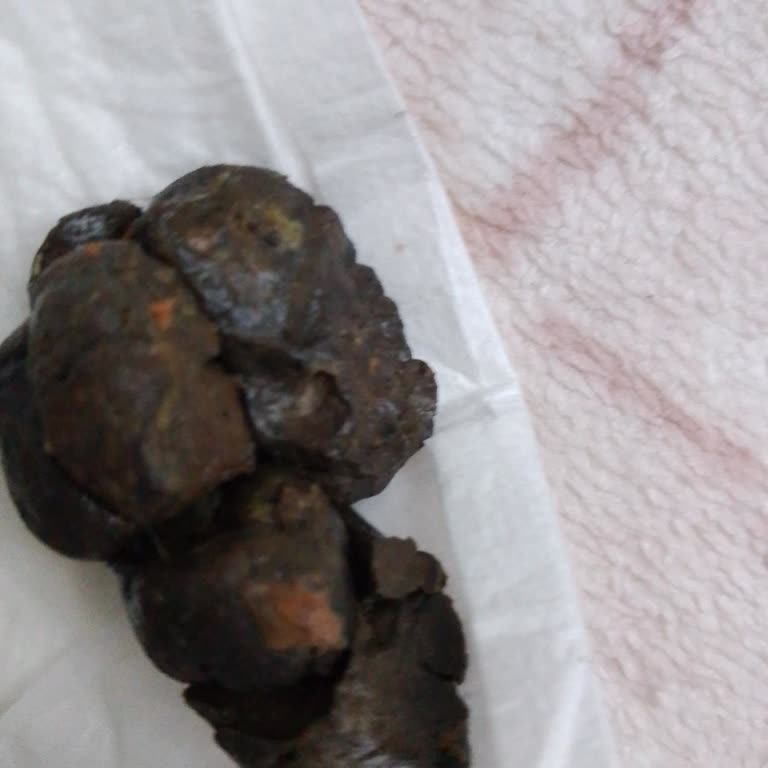 Hipp Ürününde Bebek Kaka Yapamıyor Ve Ağrıyor, Açılmamış Ambalajla İade Talep Ediyorum