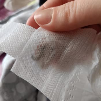 Sleepy Bebek Bezinde Cırt Cırtlı Kısımdaki Plastik Gibi Yapışma Sorunu