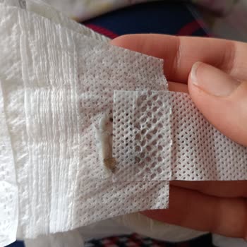 Sleepy Bebek Bezinde Cırt Cırtlı Kısımdaki Plastik Gibi Yapışma Sorunu