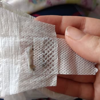 Sleepy Bebek Bezinde Cırt Cırtlı Kısımdaki Plastik Gibi Yapışma Sorunu