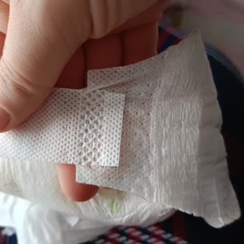 Sleepy Bebek Bezinde Cırt Cırtlı Kısımdaki Plastik Gibi Yapışma Sorunu